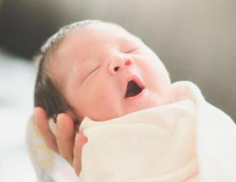 No, tu bebé no tiene caspa: qué es la costra láctea y cómo cuidarla -  Mustela - Bebés y más