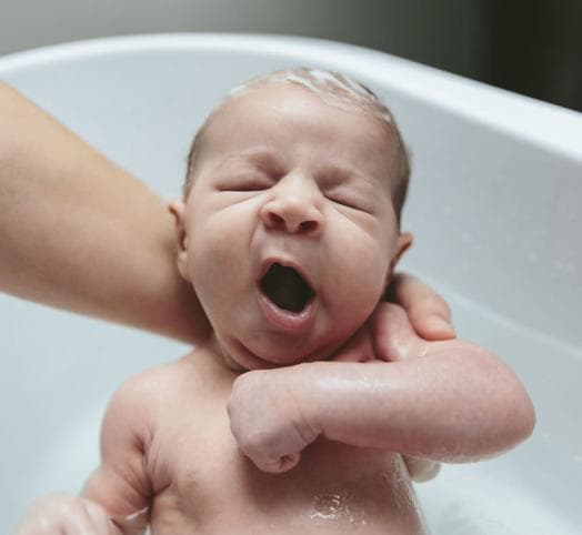 Qué es la costra láctea del bebé y cómo se quita? - Entre Tartas y